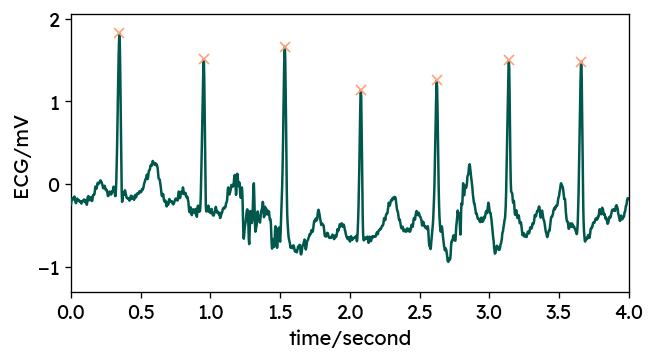 Example R peak segmentation with corrected peaks /posts/signal/ecg-library-comparison/example-ecg-peaks-corrected.png